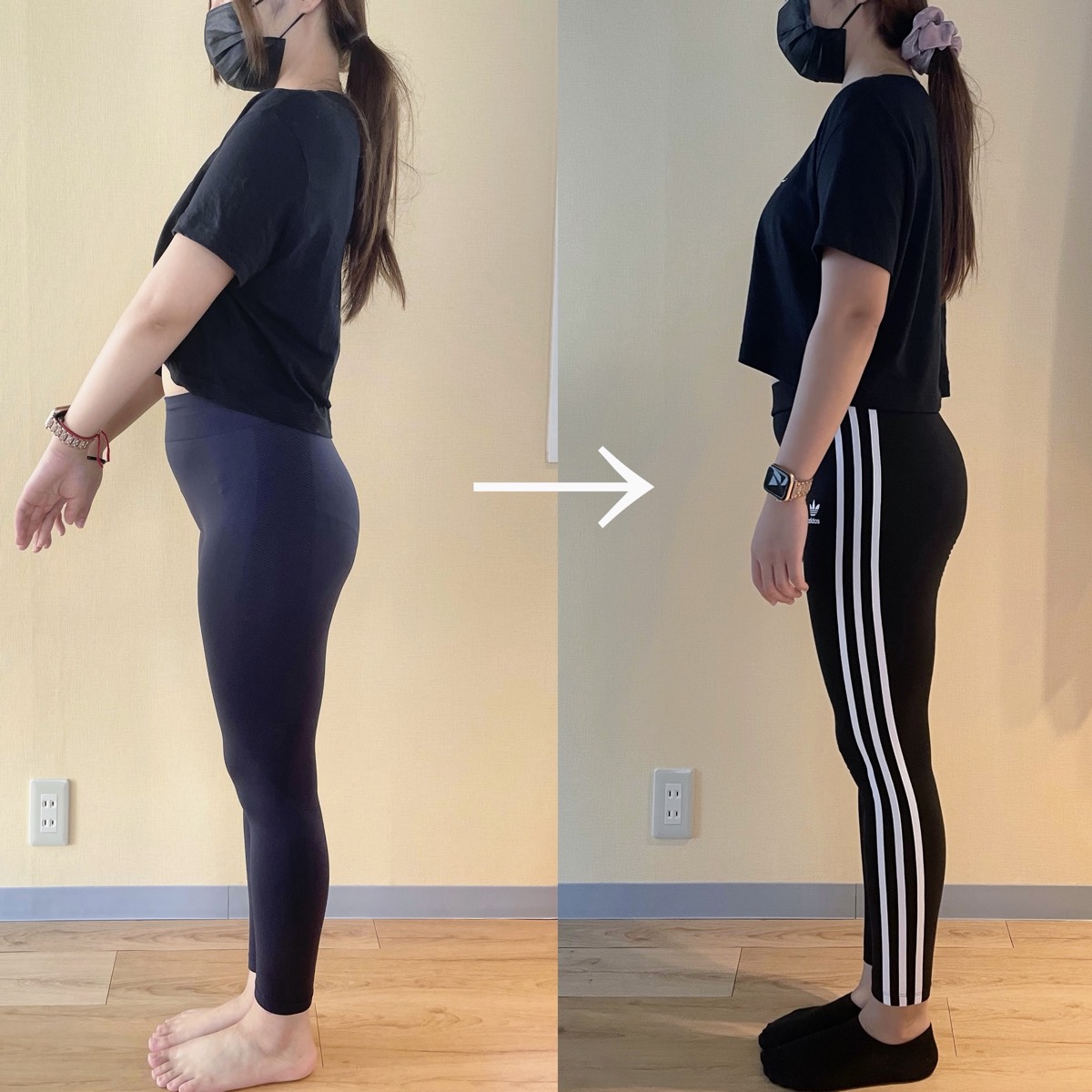 グニッとタイプ - 2ヶ月の変化